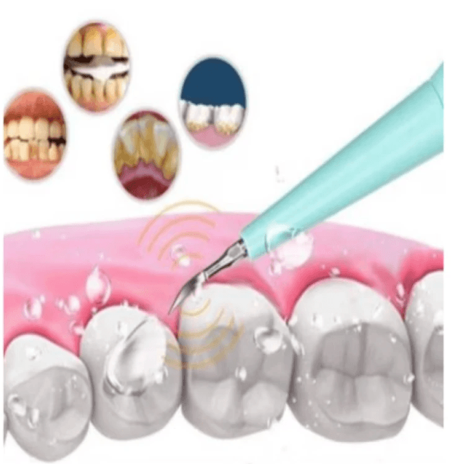 Îndepărtează placa și petele pe care periuța le lasă în urmă
